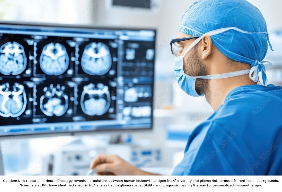 A doctor views the results of a brain scan on a computer screen.  Caption: New research in Neuro-Oncology reveals a crucial link between human leukocyte antigen (HLA) diversity and glioma risk across different racial backgrounds. Scientists at Pitt have identified specific HLA alleles tied to glioma susceptibility and prognosis, paving the way for personalized immunotherapy.